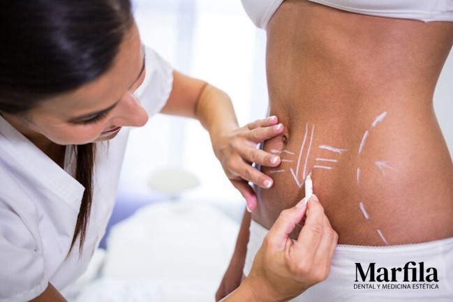 Mesoterapia